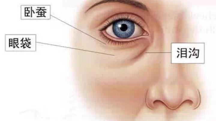 有眼袋怎么办按摩去眼袋,去眼袋眼霜真能去眼袋吗