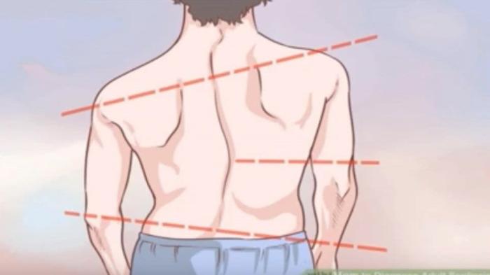 常见的体态问题--高低肩的处理方法