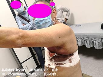 追问医院排行榜：已经死的，能不死吗？活受罪的，到底谁能治？