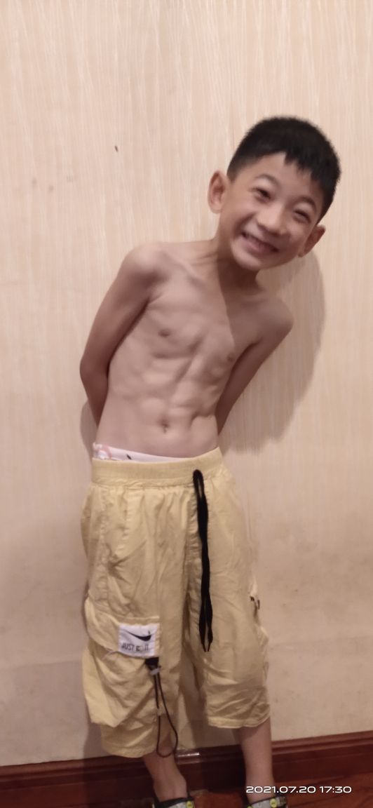 八岁40斤是不是太瘦了,八岁的孩子才40斤很瘦