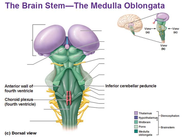 脑干海绵状血管瘤开颅手术,脑干做手术的示意图