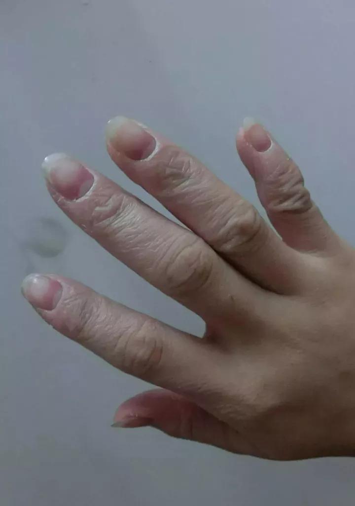 73岁人大代表研发洗衣神器，十年油汗渍霉菌，异味顽垢，轻松泡走