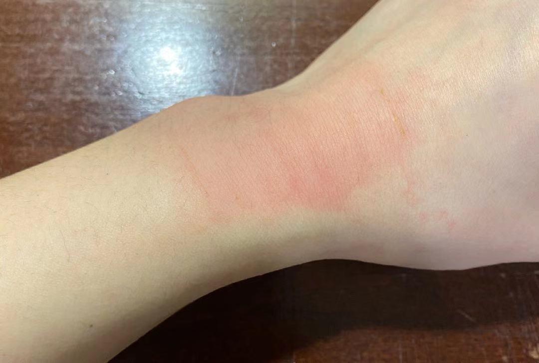 哪里痛就哪里贴膏药,哪里痛就往哪里贴