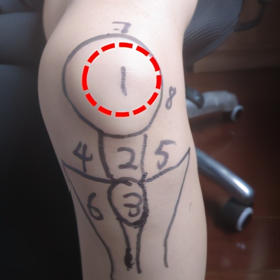 不同部位膝关节,骨科医生教你一招搞定膝盖痛