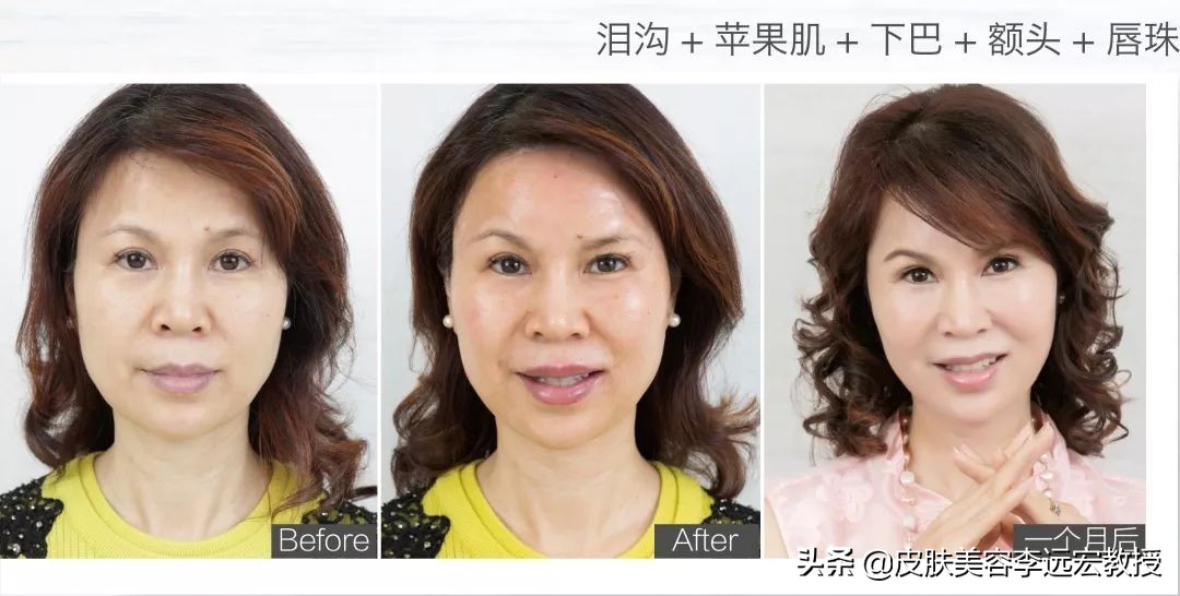 哪种口服胶原蛋白效果好,口服胶原蛋白的骗局