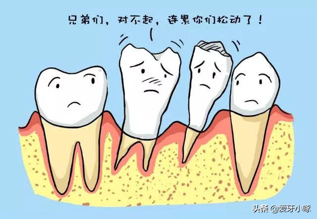 中年人牙齿松动拔了好还是脱落好,牙齿松动就拔好还是很松拔牙好
