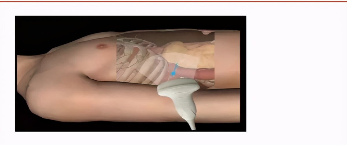 体检仪器大科普,健康体检b超
