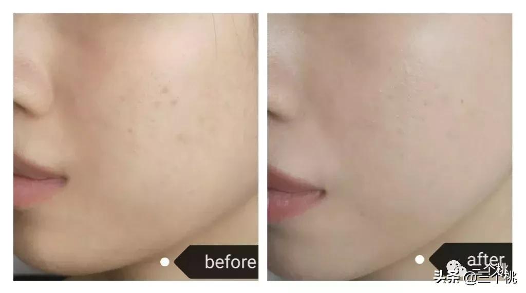 十大公认好用的粉底液评测,十大口碑最好的粉底液夏天