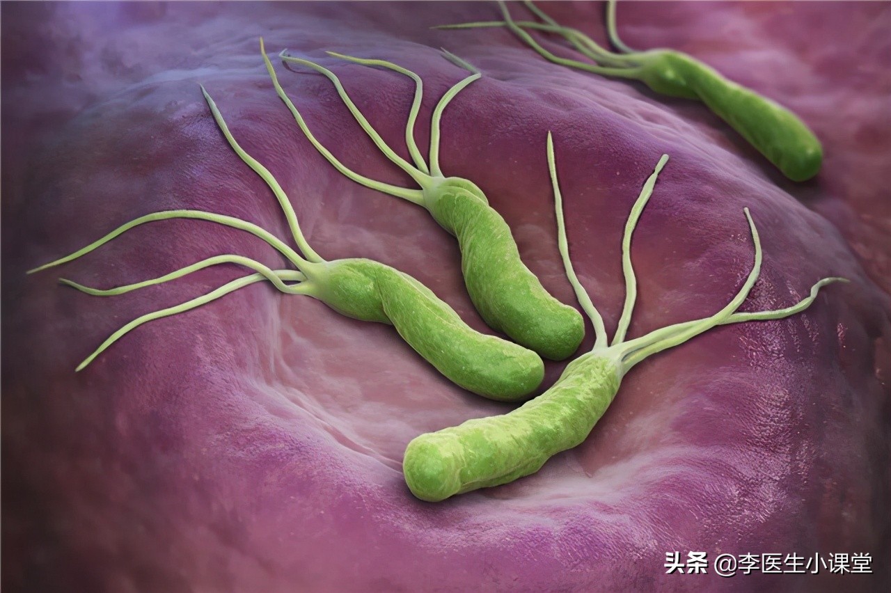 慢性浅表性胃炎伴糜烂反复发作,浅表性胃炎有三十年老反复发作