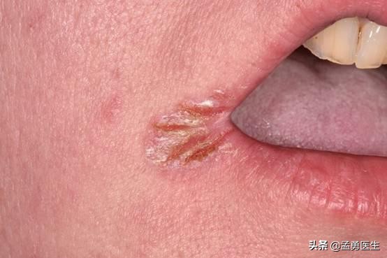 当你缺少蛋白质,身体缺乏的10种营养