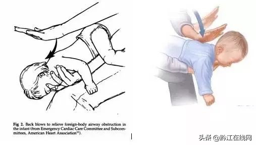 儿童被食物噎救助法,小孩吃东西噎住求助警察