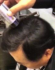 一天掉多少头发才算是脱发,一天掉多少根头发算严重脱发