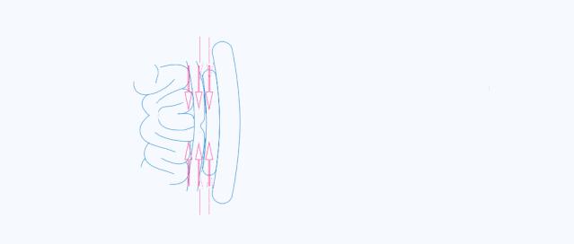 宝宝肚脐鼓起一个大包,宝宝肚脐鼓包