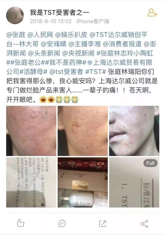张庭为什么要去做微商,微商张庭