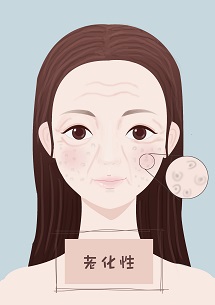 毛孔粗大是哪个内脏的原因,女人毛孔粗大是什么原因