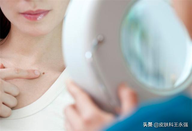 脖子上的小肉粒丝状疣怎么传染,脖子上长的小疙瘩是病毒性扁平疣