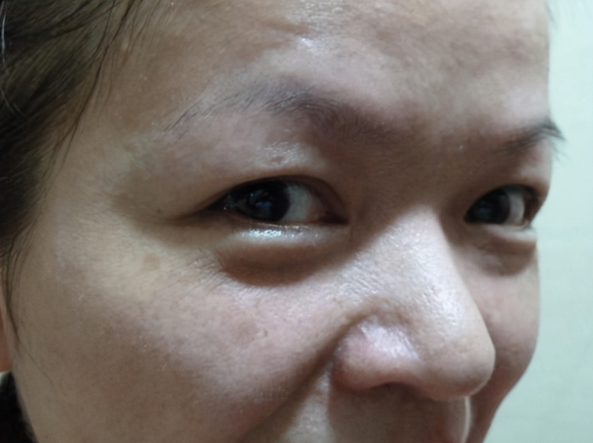 皮肤粗糙暗沉如何食疗,皮肤粗糙暗沉这样做就会嫩白