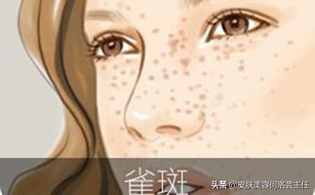 脸上有黑色素沉着斑怎能治好,脸上有色斑的护肤教程
