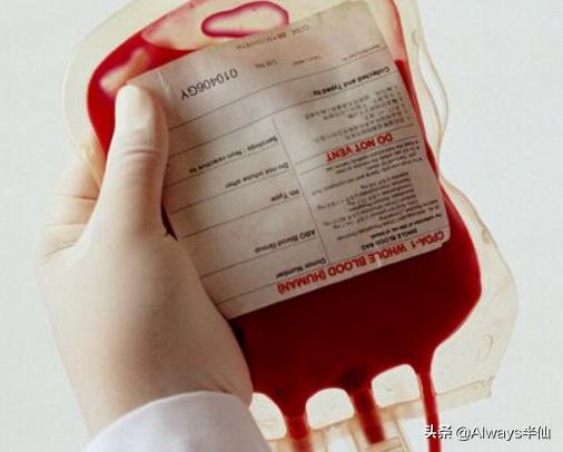 最稀有的血型熊猫,全世界最稀有的三种血型图片