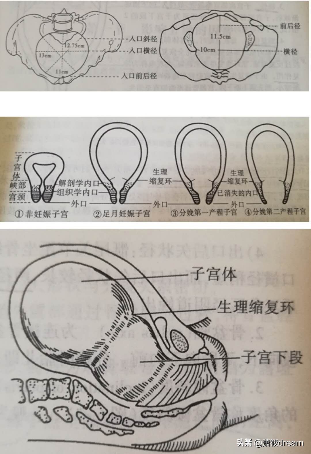 有的孕妈明明符合顺产的标准，为何还要剖宫产？