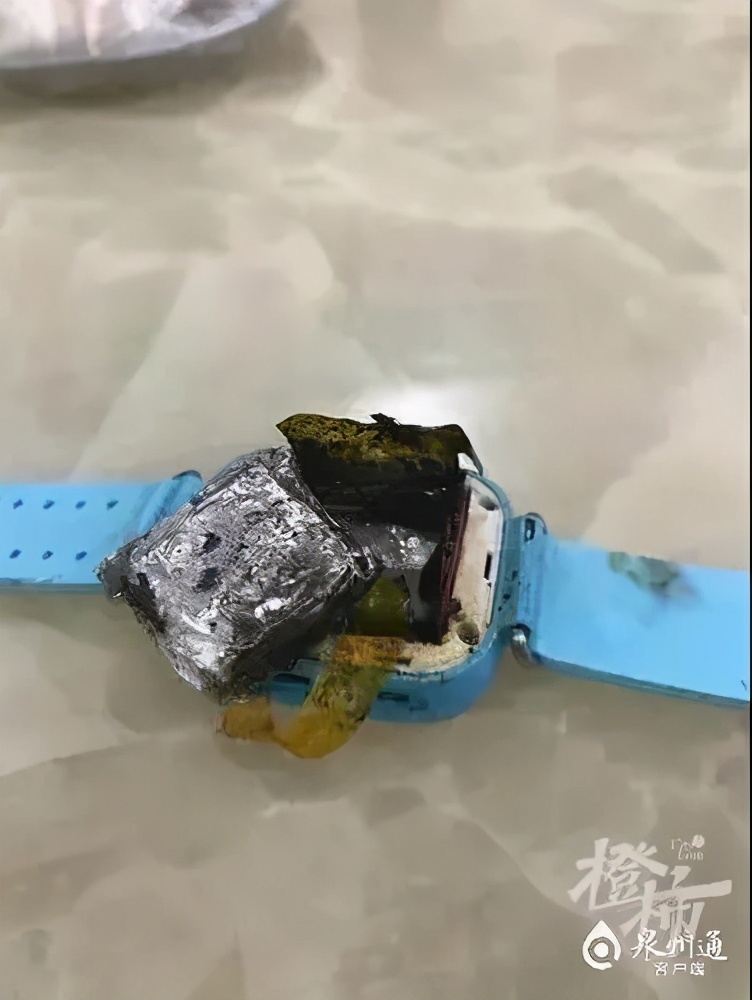 电话手表着火三岁小孩被烧伤视频,儿童电话手表突然着火的新闻视频
