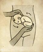 脐带绕颈胎位不正怎么办,胎位不正医生调胎位痛苦