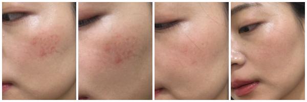 薏仁化妆水排行榜前十名,平价好用薏仁水有哪些品牌