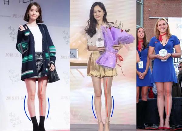 腿不直小腿外翻可以矫正过来吗,腿不直小腿外翻其实坐着就能解决