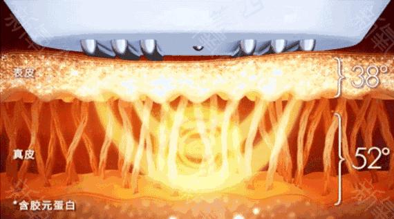 19岁姑娘打溶脂针,女子打美容针脸肿