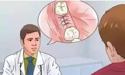 拔完牙吐口水有血,拔完牙为什么不能吐口水