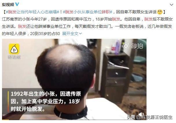 长而稀疏的头发该怎么理才好呢,发量少细软能看到头皮发型