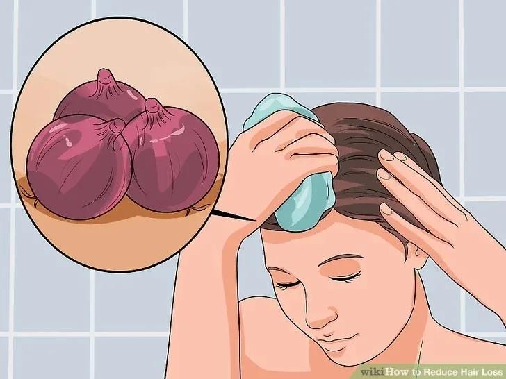 减少脱发的洗发水,脱发毛囊减少