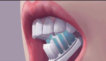 怎样把黄牙刷白,怎样快速把黄牙刷白