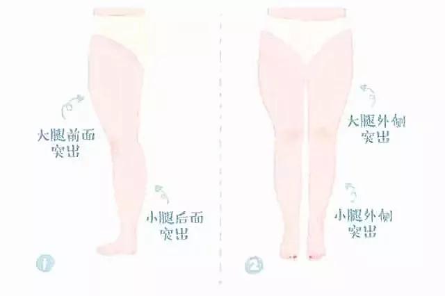 大腿前侧凸起一块肉怎么回事,大腿前侧突出什么样子