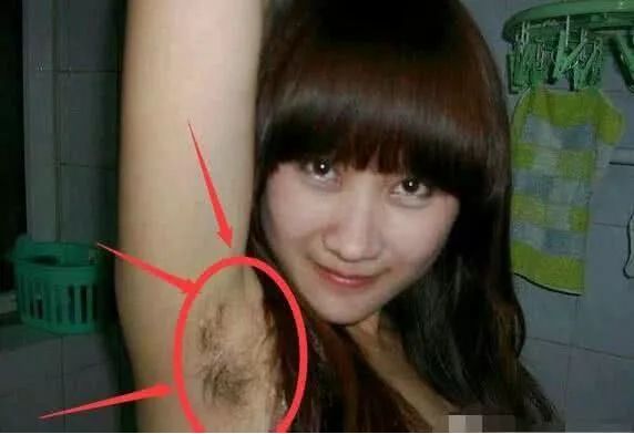 腋下一边长毛一边没长这是为什么,女性腋下一直没有长毛是什么原因