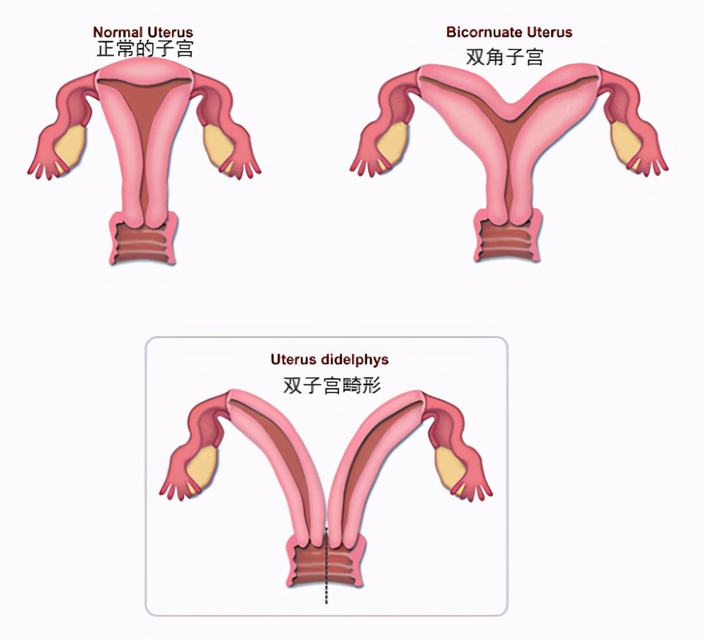 18岁女孩每隔十天又流血,18岁女孩一个月月经来二次