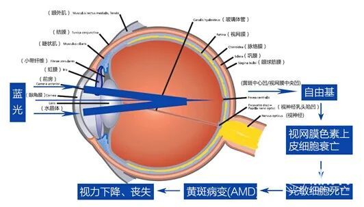 笔记本电脑抗蓝光和护眼屏的区别,防蓝光护眼电脑屏幕真的能有效吗