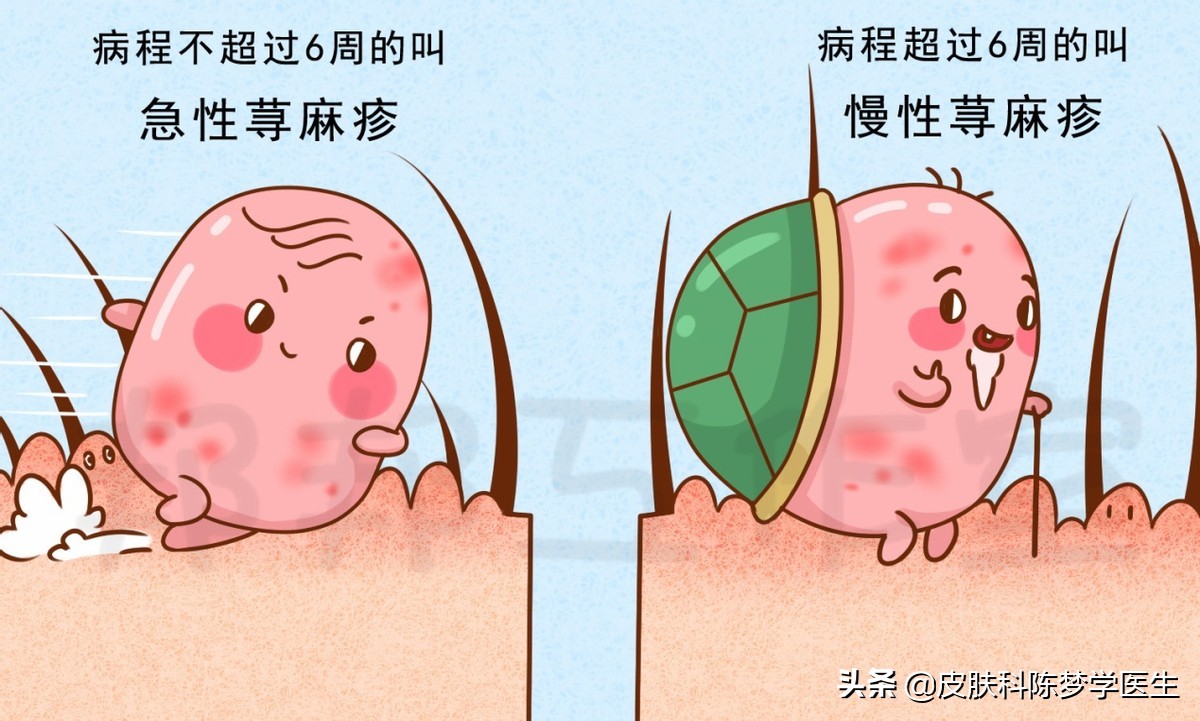 荨麻疹得了一年还可以治好吗,慢性荨麻疹治不好有什么后果