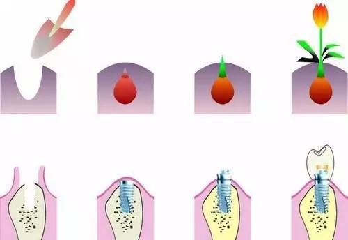 牙不疼不痒有必要定期看牙医吗,牙不疼可以检查出口腔病吗