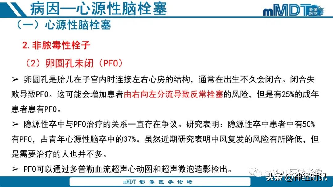 缺血性脑卒中护理课件,缺血性脑卒中讲课ppt