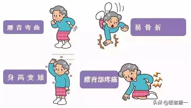 补钙就能解决骨质疏松吗,单纯补钙能有效预防骨质疏松吗