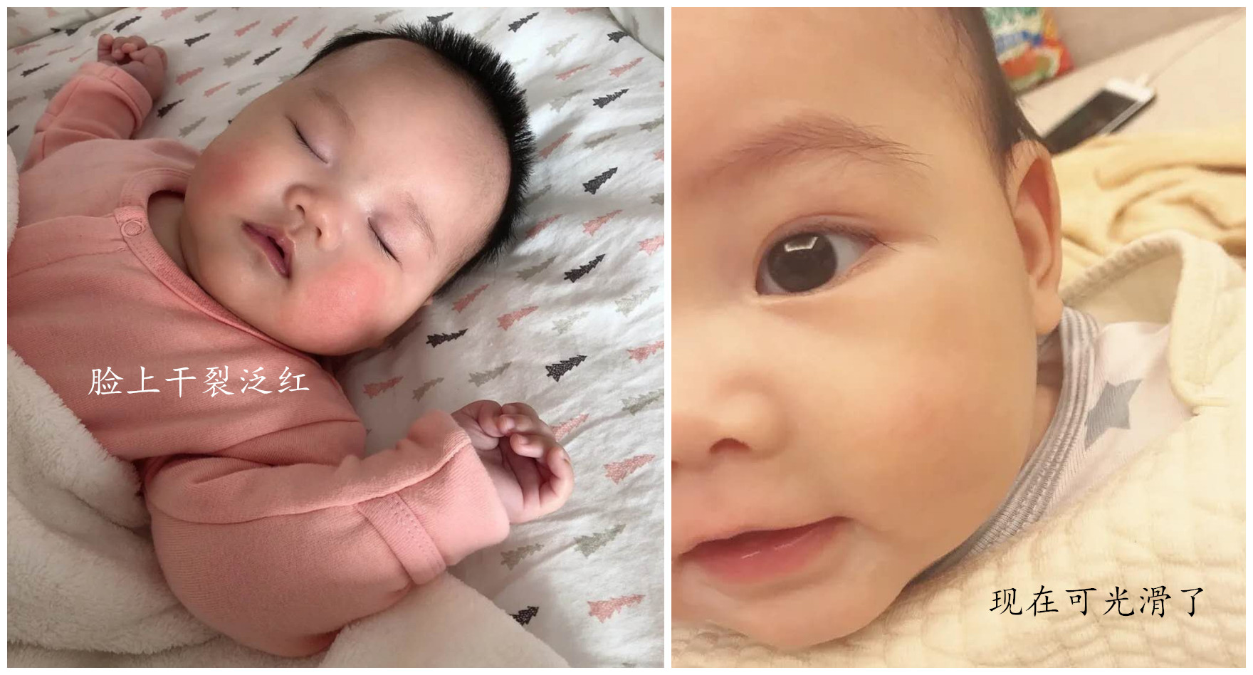 郁美净无硅油儿童面霜,郁美净为什么突然买不到了