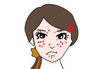 我的“战痘”好物，贵妇级修丽可效果惊人，平价版狮王性价比超高