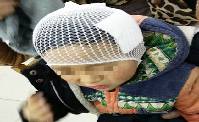 3岁孩子摔倒磕到前脑门怎么办,3岁小孩摔倒磕到头走路头疼