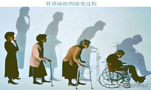 人老了身高萎缩厉害怎么办？提醒：若能坚持3个习惯，或能帮你忙