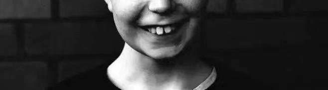 错过牙齿矫正时机,儿童牙齿矫正的3个黄金时期