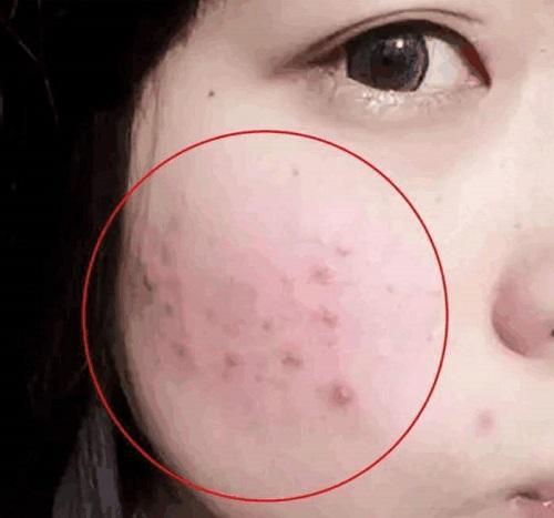 上海涤诺硫磺皂的作用与功效,硫磺皂的作用与功效可以洗头吗