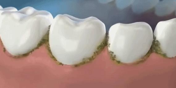 最好用的牙膏排行榜前十名,选哪个牌子的牙膏最安全好用