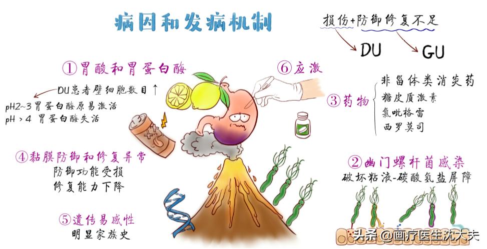 胃溃疡的原理动画,胃溃疡的原因动画演示