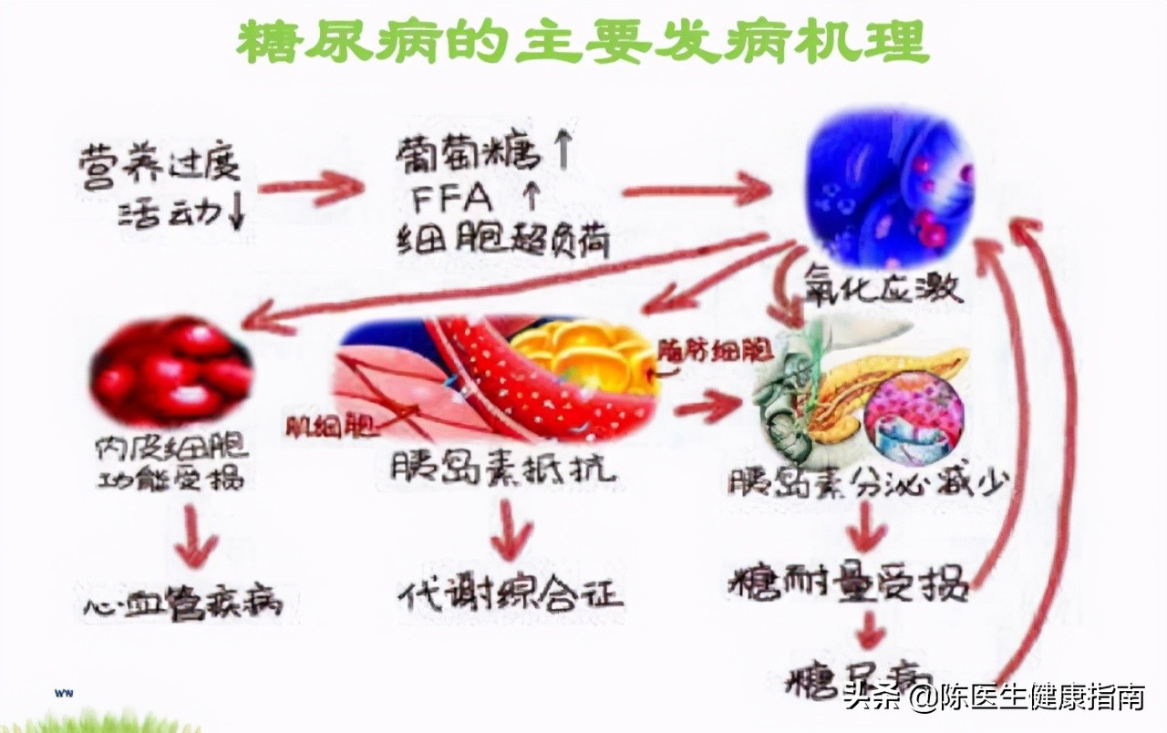 糖尿病胰岛功能会越来越差么,二型糖尿病胰岛功能会越来越差吗